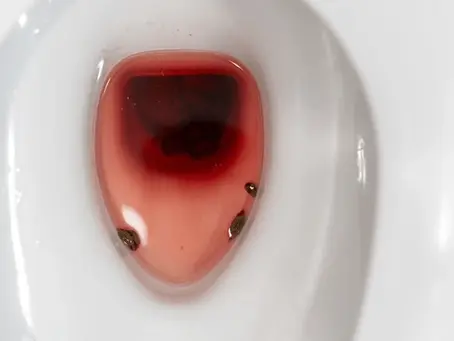 "I could see fetal parts as I passed clots" I'm not okay