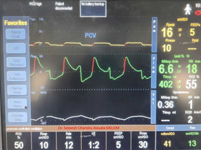 Early Cycling or Late Cycling?