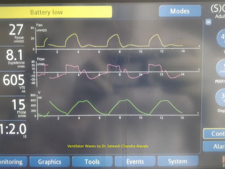 Identifying Reverse Trigger in Volume Control Mode