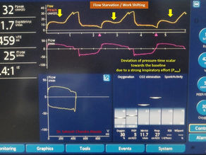 What is Work Shifting?