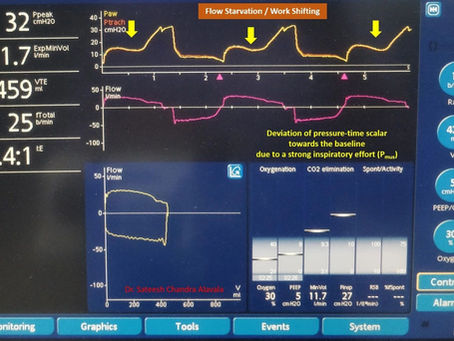 What is Work Shifting?