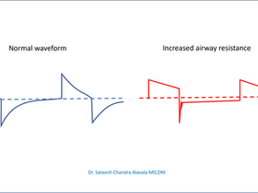 Identifying Increased Airway Resistance in Pressure Control Mode