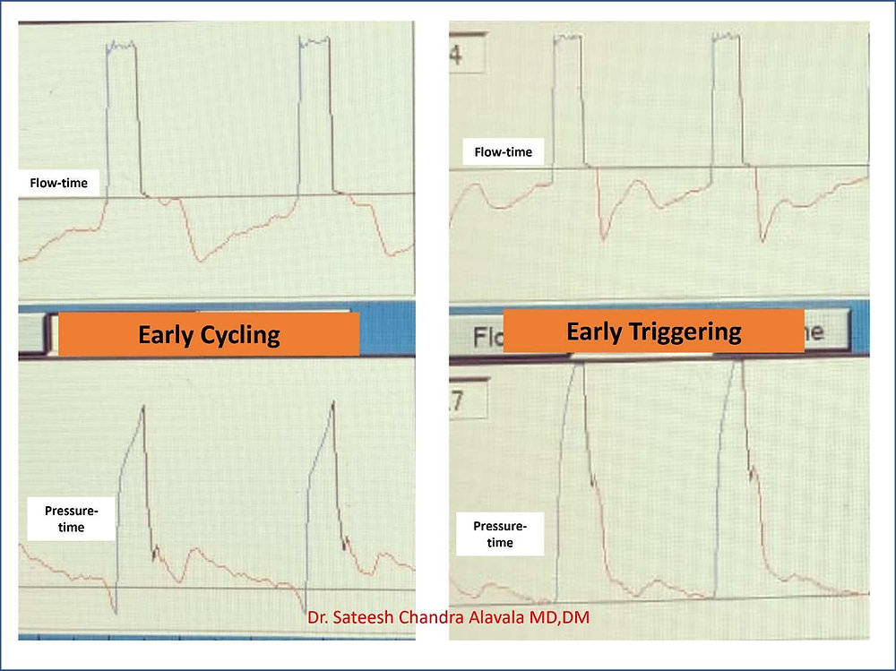 Trigger Phase Early Cycling Vs Early Trigger