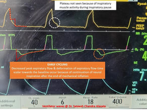 Identifying Early Cycling in Volume Control Mode
