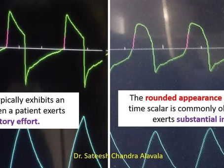 How Flow Waveform Morphology Reveals Patient Effort?