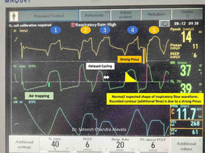 Hiccups Hiding in the Waveforms