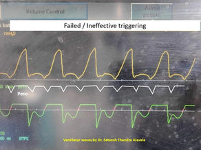 Looks Like Early Cycling? Think Again- It's Delayed Cycling