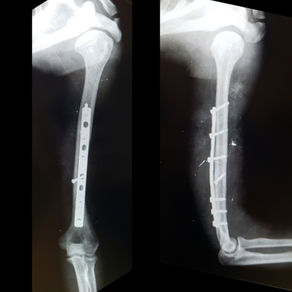 O acesso posterior do úmero