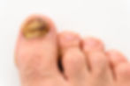 When you lay your feet flat against the floor, you expect your toes to point straight forward and sit perpendicular to the floor’s...