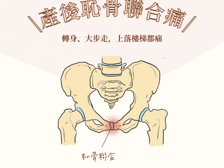 產後恥骨聯合痛|轉身、大步走,上落樓梯都痛