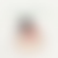 上斜方肌酸痛|點解上斜方肌成日都咁脹?