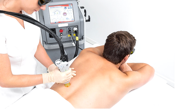 Laser Hair Removal | Ballymena | Laserway Cosmetic Laser Clinic