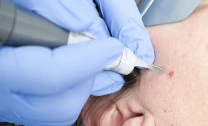 Dermatology.jpg.webp