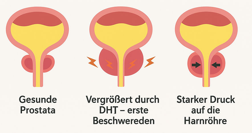 1756990440-Prostatabeschwerden_edited.jpg