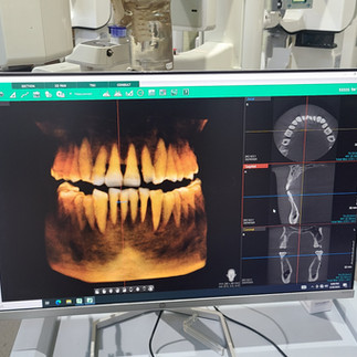 Vatech Pax I 3D CT FOV 8X8 Used/Refurbished Digital Dental X-ray/CBCT