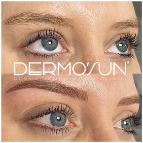 TTechnique sourcils Poil à Poil, microbmading saint raphael frejus
Découvrez nos sourcils blonds en maquillage permanent chez Dermo'Sun, centre de dermopigmentation numéro 1 en France à Saint-Raphaël, Fréjus, Cannes .
hairstroke poil à poil sainte maxime