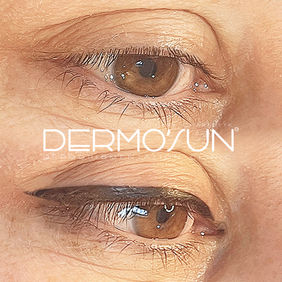 Vous rêvez d’un eyeliner fin haut semi-permanent à Cannes pour intensifier votre regard sans effet maquillé ? Chez Dermo'Sun Sainte-Maxime, nous utilisons des pigments de haute qualité pour créer un liner invisible au ras des cils supérieurs. Une solution parfaite pour un regard mis en valeur durablement et sans contrainte.