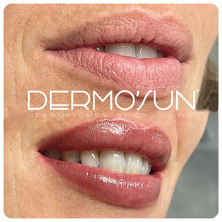 Obtenez des lèvres à l'effet rouge à lèvres rosé élégant grâce à la technique contour et dégradé chez Dermo'Sun, centre de dermopigmentation numéro 1 en France, à Saint-Raphaël, Fréjus, Cannes et Chantilly. Des pigments de haute qualité pour un résultat naturel et harmonieux.