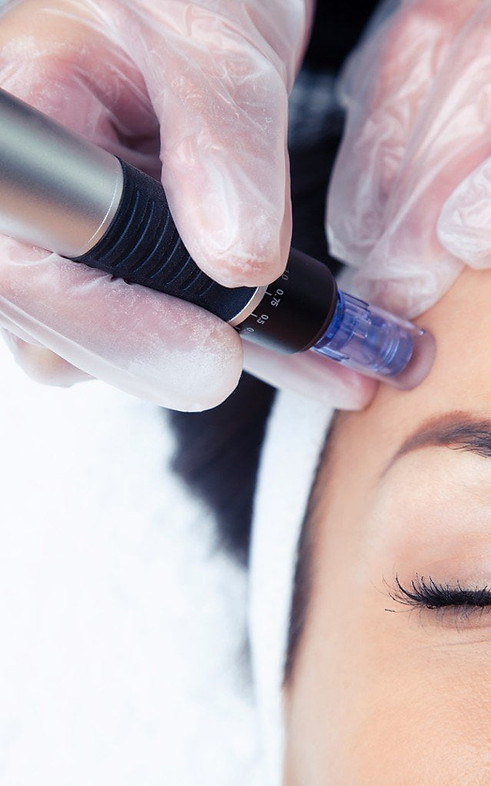 Microneedlin online course