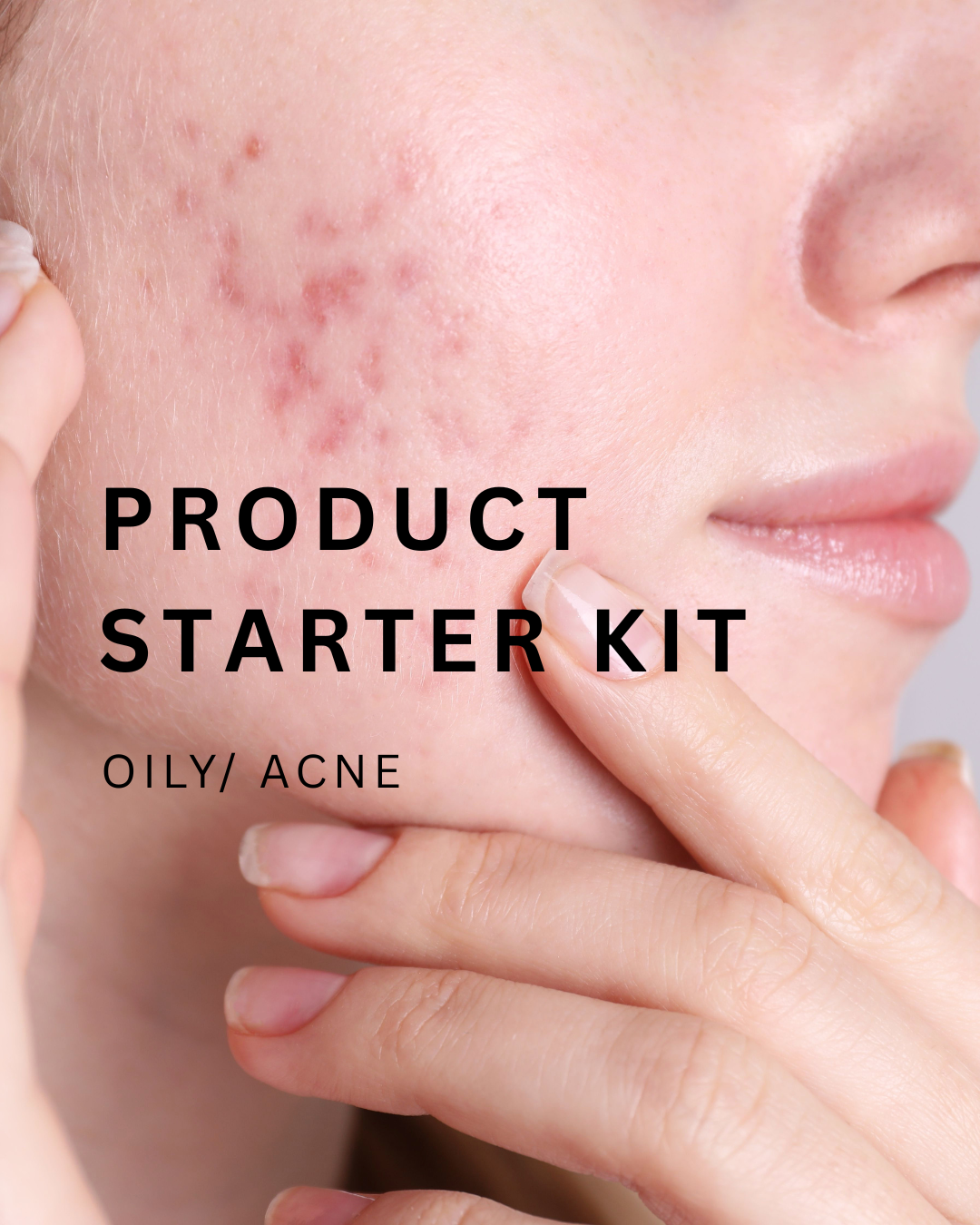 OILY / ACNE starter kits