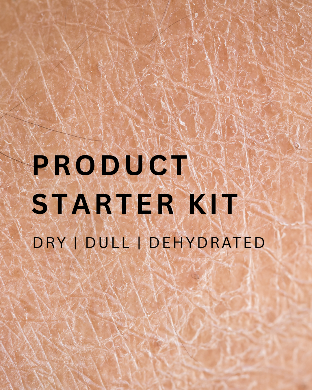 DRY | DULL | DEHYDRATED starter kit
