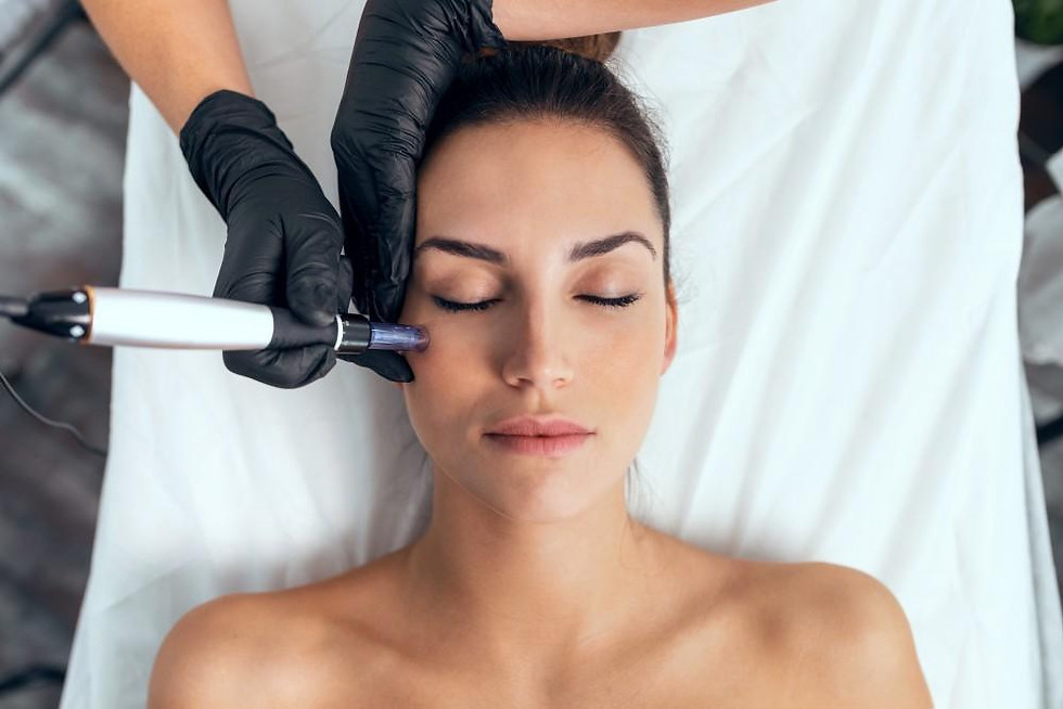 Microneedling course Worthing