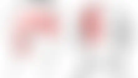 Prise en charge des céphalées cervicogéniques : rôle de l'ostéopathie et de la thérapie manuelle