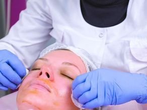 Exploring the Anti-Aging Benefits of Chemical Peels: Diminishing Fine Lines and Wrinkles