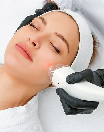Deep Dermal Theraphy - Laser Treatment.jpg
