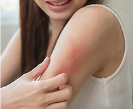 かゆみが出てしまっている女性