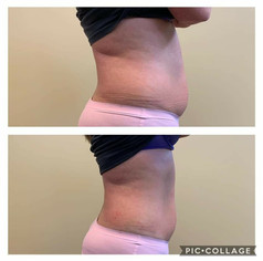 Contouring_Results_09