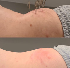 Waist-02-201025