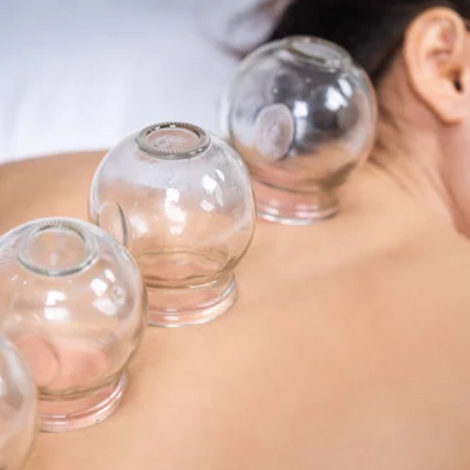 Chinese Medicine cupping