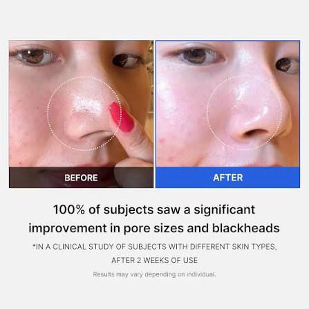 Miniatura: Medicube - Zero Pore Pad 2.0