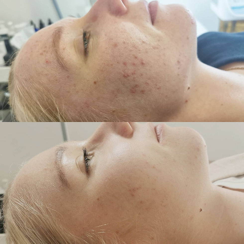 Gesichtsbehandlungen