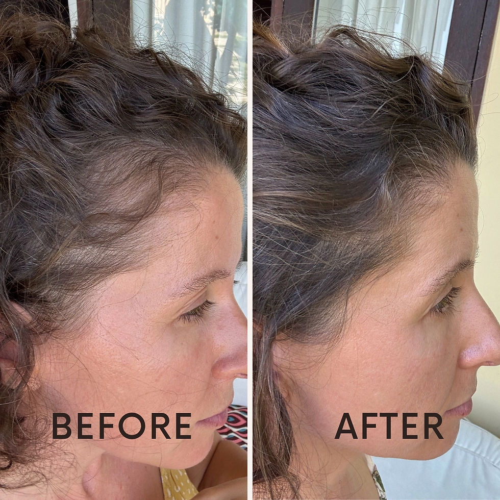 Side-by-side images showing a woman's hair before and after treatment; noticeable hair growth. Text reads "BEFORE" and "AFTER".