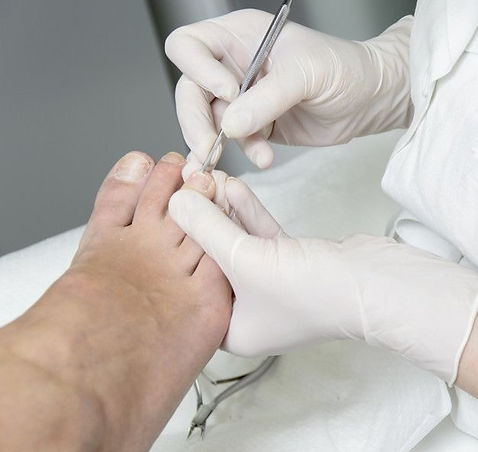 gespecialiseerde voetverzorging