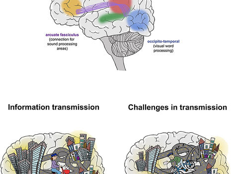 The magical art of magnetic resonance imaging to study the reading brain