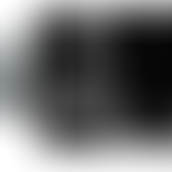 Malaysian Medical Center Executes Heel Bone Replacement Using 3D Printing