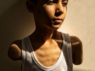 Retrato de niño amputado por un ataque israelí en Gaza, la imagen del año en el World Press Photo
