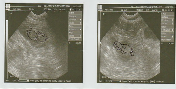 Roses 2019 Ultrasound.jpeg