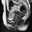 mri-abdomen2.jpg