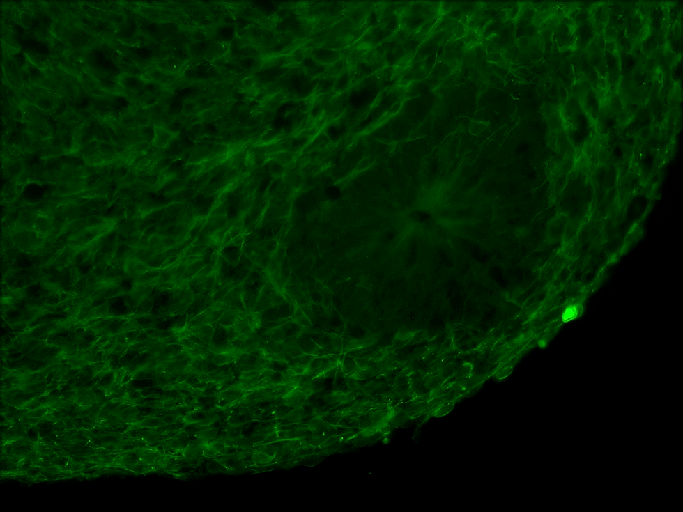 Thumbnail: Organoid Section