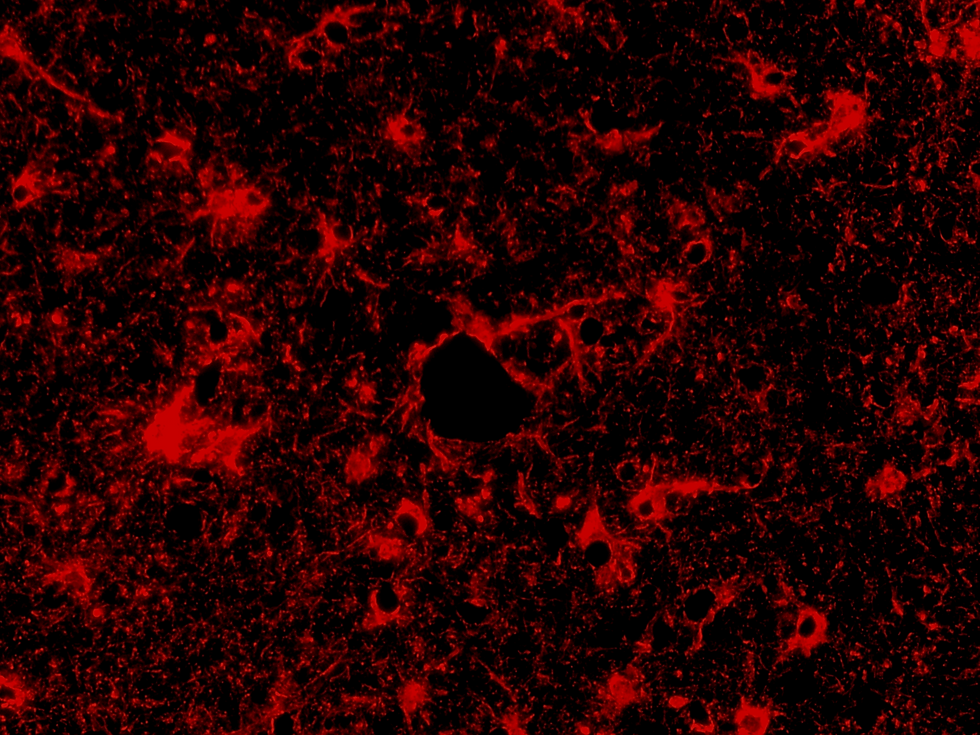 Thumbnail: Brain Tissue Section