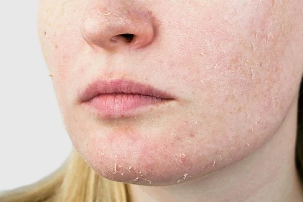 facial-cleanser-dry-skin-600x400.webp
