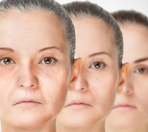 aging-process-rejuvenation-anti-aging.jpg