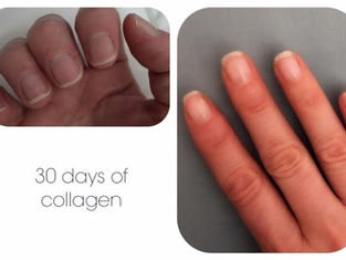 Why does our body need collagen?