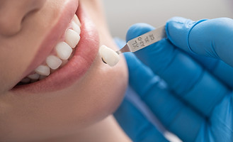 Dental crown situating near mouth of hap