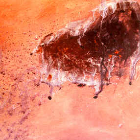 Abstract 10
