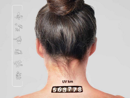 ULSM Dermatology Service marks Euromelanoma Day